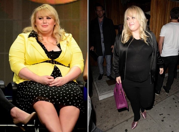 Celebs Who Had Gastric Sleeve Surgery To Stay Fit - How Many Pounds ...