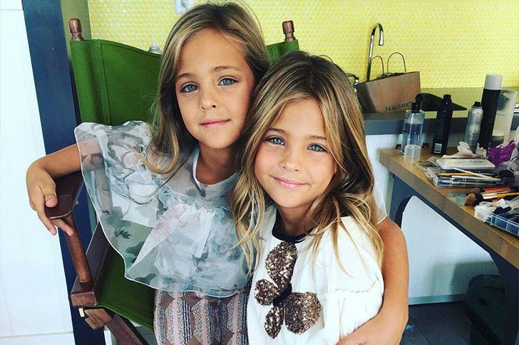Nobody Thought It Was Possible But These Identical Sisters Have Grown ...